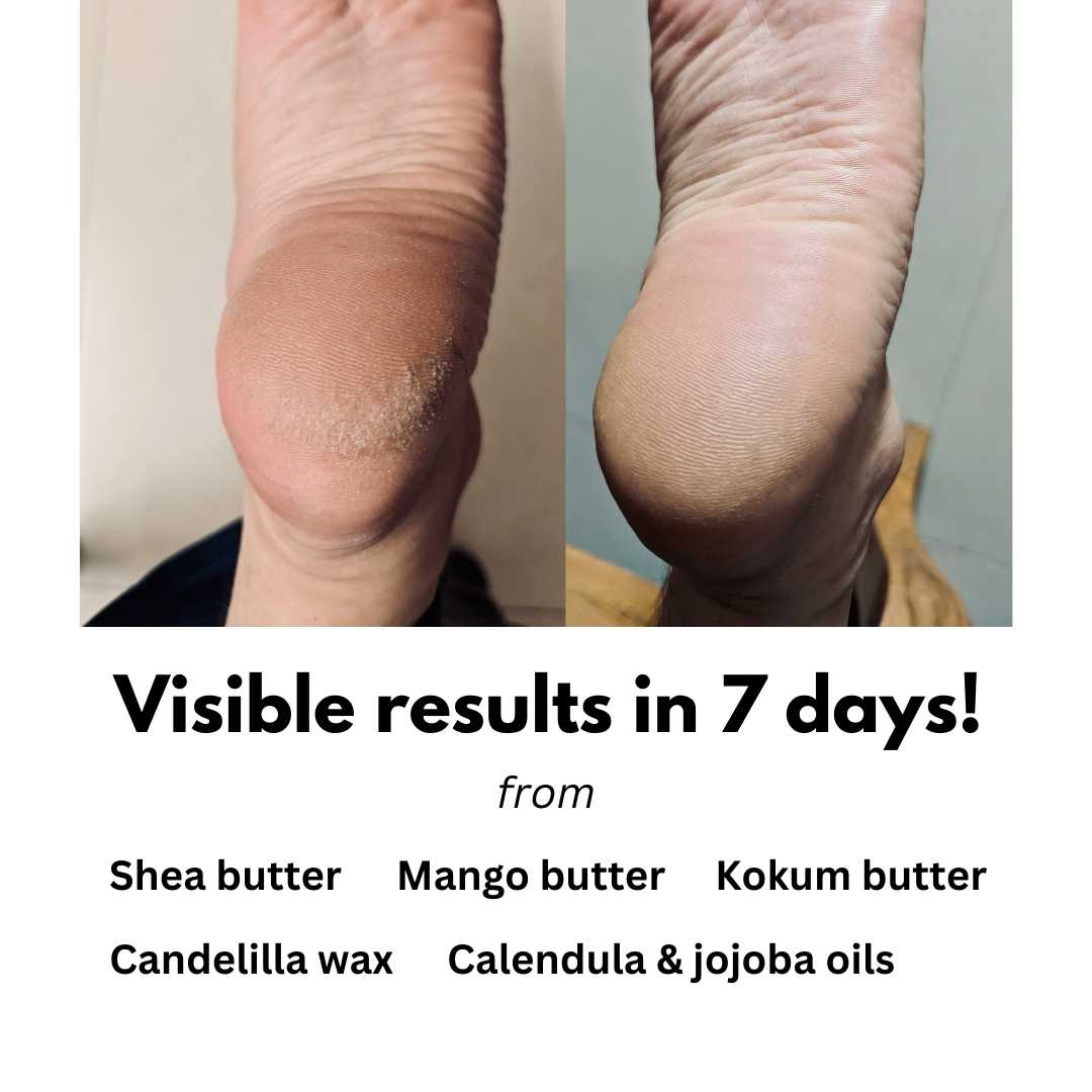 BAREFOOT heel repair balm 40g